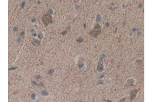 Detection of HMGCS in Human Brain Tissue using Polyclonal Antibody to Hydroxymethylglutaryl Coenzyme A Synthase (HMGCS)