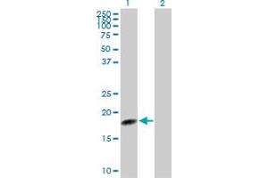 Western Blot analysis of TSEN15 expression in transfected 293T cell line by TSEN15 MaxPab polyclonal antibody. (TSEN15 anticorps  (AA 1-171))