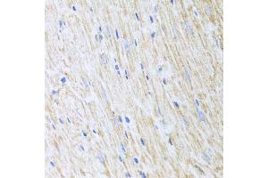 Immunohistochemistry of paraffin-embedded mouse heart using RCN2 antibody (ABIN5975169) at dilution of 1/100 (40x lens). (RCN2 anticorps)