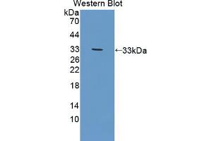 Western blot analysis of the recombinant protein. (DOK3 anticorps  (AA 45-310))