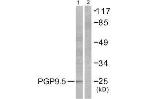 Western Blotting (WB) image for anti-Ubiquitin Carboxyl-terminal Esterase L1 (Ubiquitin Thiolesterase) (UCHL1) (C-Term) antibody (ABIN1848742) (UCHL1 anticorps  (C-Term))