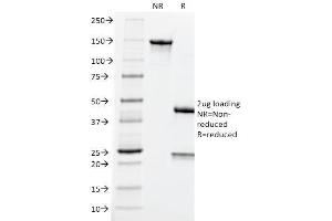 SDS-PAGE Analysis Purified CEA Mouse Monoclonal Antibody (CEA31).