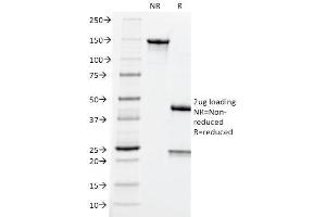 SDS-PAGE Analysis Purified CEA Mouse Monoclonal Antibody (CEA31). (CEACAM5 anticorps)