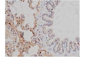 ABIN6267331 at 1/200 staining Rat lung tissue sections by IHC-P. (LYN anticorps  (pTyr507))