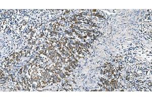 IHC analysis of DRP1/DNM1L using anti-DRP1/DNM1L antibody (ABIN7602180). (Dynamin 1-Like anticorps  (AA 618-736))