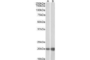 ABIN5539501 (0. (Deoxyuridine Triphosphatase (DUT) (Internal Region) anticorps)