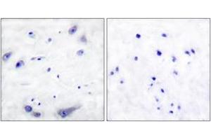 Immunohistochemistry (IHC) image for anti-Tyrosine Hydroxylase (TH) (AA 1-50) antibody (ABIN2888584) (Tyrosine Hydroxylase anticorps  (AA 1-50))