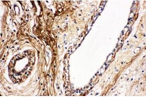 IHC analysis of Protein C using anti- Protein C antibody .