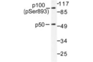 Image no. 1 for anti-Nuclear Factor of kappa Light Polypeptide Gene Enhancer in B-Cells 1 (NFKB1) (pSer893) antibody (ABIN318080)