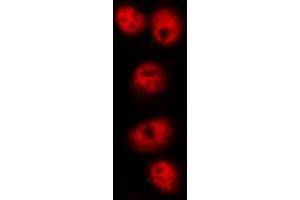 ABIN6268985 staining HuvEc by IF/ICC.