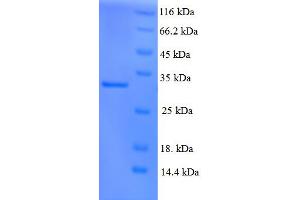 SDS-PAGE (SDS) image for Xeroderma Pigmentosum, Complementation Group C (XPC) (AA 496-734) protein (His tag) (ABIN5710632) (XPC Protein (AA 496-734) (His tag))