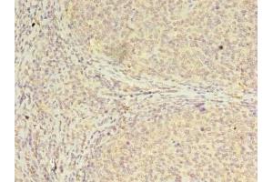 Immunohistochemistry of paraffin-embedded human tonsil tissue using ABIN7147697 at dilution of 1:100 (CBX2 anticorps  (AA 1-211))