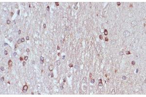 Immunohistochemistry of paraffin-embedded Rat brain using TPD52 Polyclonal Antibody at dilution of 1:100 (40x lens). (TPD52 anticorps)