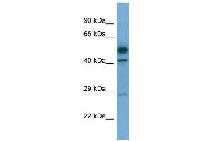 Western Blotting (WB) image for anti-serine/threonine Kinase 17a (STK17A) (C-Term) antibody (ABIN2787865) (STK17A anticorps  (C-Term))