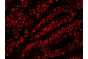 Immunofluorescence (IF) image for anti-Minichromosome Maintenance Complex Component 2 (MCM2) (AA 1-50) antibody (ABIN7448987) (MCM2 anticorps  (AA 1-50))
