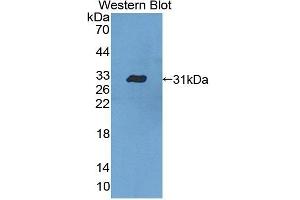 Detection of Recombinant CASP10, Human using Polyclonal Antibody to Caspase 10 (CASP10) (Caspase 10 anticorps  (AA 223-459))