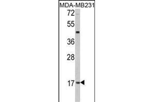 Western blot analysis of hLep- (ABIN390092 and ABIN2840608) in MDA-M cell line lysates (35 μg/lane). (Leptin anticorps  (C-Term))