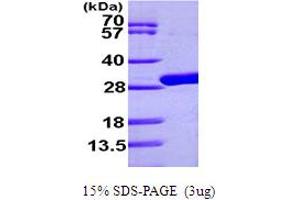 UDP (AA 1-253) (Active) protein (His tag)