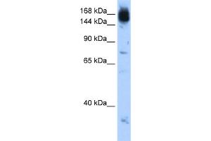 WB Suggested Anti-NCAPD2 Antibody Titration:  0. (NCAPD2 anticorps  (C-Term))