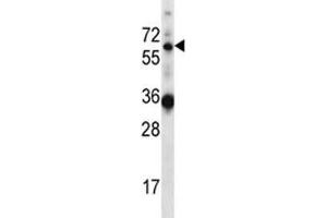 GATAD2B antibody western blot analysis in mouse heart tissue lysate (GATAD2B anticorps  (AA 1-30))