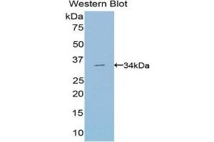 Western Blotting (WB) image for anti-Suppressor of Variegation 4-20 Homolog 2 (SUV420H2) (AA 2-279) antibody (ABIN1078551) (SUV420H2/KMT5C anticorps  (AA 2-279))