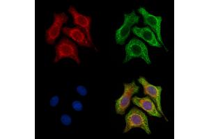 ABIN6257428 and ABIN6275868 staining H2O2 treated Hela cells by IF/ICC. (CD90 anticorps  (Internal Region))