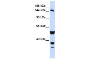 ABI3BP antibody used at 1 ug/ml to detect target protein. (ABI3BP anticorps)