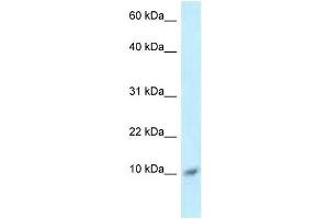 Western Blot showing S100A8 antibody used at a concentration of 1 ug/ml against ACHN Cell Lysate