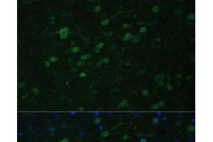 Immunofluorescence analysis of Mouse brain using KMT2E Polyclonal Antibody at dilution of 1:100. (MLL5/KMT2E anticorps)