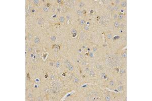 Immunohistochemistry (IHC) image for anti-Carboxypeptidase E (CPE) antibody (ABIN1876646) (CPE anticorps)