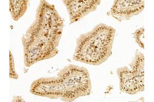 ABIN7094900 and ABIN7098953 at 1/100 staining Mouse colorectal tissue by IHC-P. (LHX6 anticorps  (Internal Region))