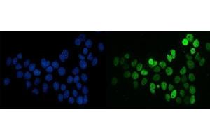 IF analysis of splicing factor 1 using anti-splicing factor 1 antibody (ABIN7600193). (Splicing Factor 1 anticorps  (AA 160-266))