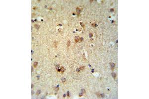 LCAT Antibody IHC analysis in formalin fixed and paraffin embedded brain tissue followed by peroxidase conjugation of the secondary antibody and DAB staining.