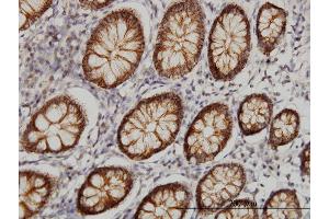 Immunoperoxidase of monoclonal antibody to CLDN1 on formalin-fixed paraffin-embedded human colon.