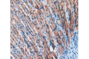 Used in DAB staining on fromalin fixed paraffin- embedded stomach tissue
