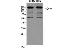 Western Blot (WB) analysis of KB-UV HeLa using Integrin beta2 Polyclonal Antibody diluted at 1:500. (Integrin beta 2 anticorps  (Internal Region))