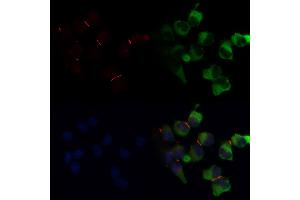 ABIN6266146 and ABIN6268691 staining  by IF/ICC. (TJP1 anticorps)