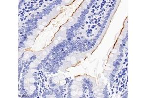 Immunohistochemistry analysis of paraffin-embedded rat duodenum using,SLC22A1 (ABIN7075663) at dilution of 1: 1200 (SLC22A1 anticorps)