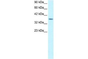 RPS16 antibody (20R-1083) used at 5 ug/ml to detect target protein.