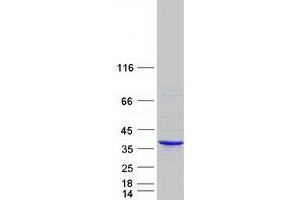Validation with Western Blot