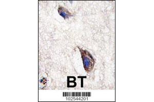 Formalin-fixed and paraffin-embedded human brain tissue reacted with DKK3 antibody , which was peroxidase-conjugated to the secondary antibody, followed by DAB staining.