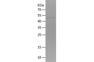 Western Blotting (WB) image for Hepatocyte Growth Factor (Hepapoietin A, Scatter Factor) (HGF) (AA 496-728) protein (His-IF2DI Tag) (ABIN7123306)