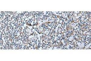 Immunohistochemistry of paraffin-embedded Human tonsil tissue using VDAC1 Polyclonal Antibody at dilution of 1:35(x200) (VDAC1 anticorps)