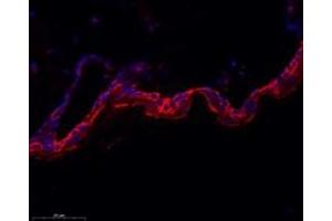 Immunofluorescent analysis of paraformaldehyde-fixed rat skin using,IFNL3 (ABIN7074356) at dilution of 1: 400