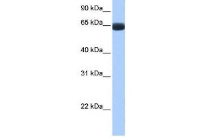Human Lung; WB Suggested Anti-ARHGAP28 Antibody Titration: 0. (ARHGAP28 anticorps  (C-Term))