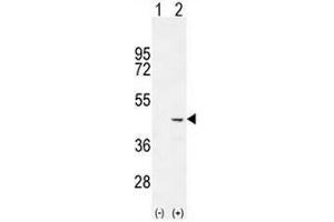 Western blot analysis of COCH (arrow) using rabbit polyclonal COCH Antibody (C-term) .