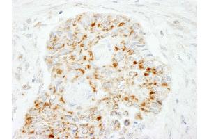 anti-Mitochondrial Antiviral Signaling Protein (MAVS) (AA 150-200) antibody