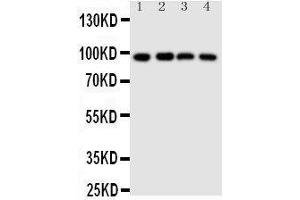 Anti-SIDT1 antibody, Western blotting Lane 1: HELA Cell Lysate Lane 2: COLO320 Cell Lysate Lane 3: SW620 Cell Lysate Lane 4:  Cell Lysate (SIDT1 anticorps  (N-Term))