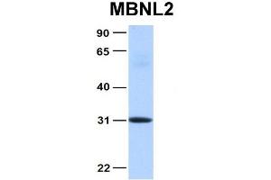 Host:  Rabbit  Target Name:  MBNL2  Sample Type:  Human Fetal Heart  Antibody Dilution:  1. (MBNL2 anticorps  (Middle Region))