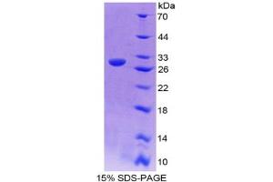 Image no. 1 for Kallikrein-Related Peptidase 4 (KLK4) (AA 32-256) protein (His tag) (ABIN6236649) (Kallikrein 4 Protein (AA 32-256) (His tag))